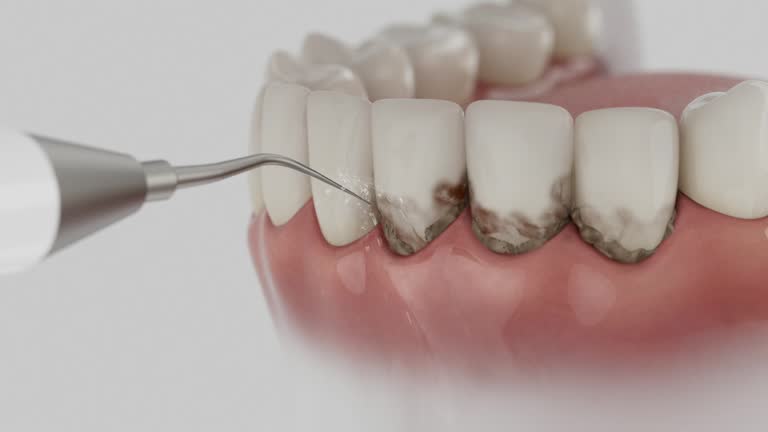 Reliable Tooth Extraction contractor in Stonewall County County, TX by Dentist Open Now